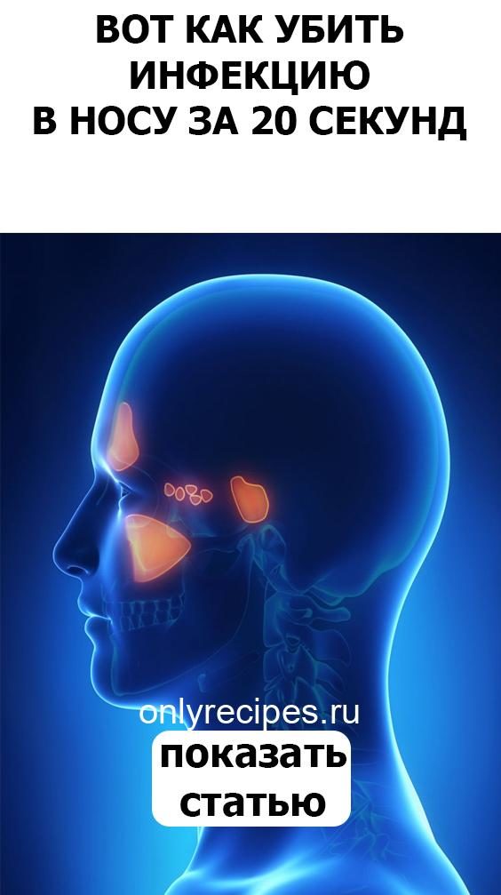831-2099123
