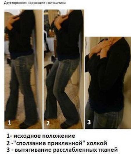 doktor-bubnovskiy-kak-ubrat-vdoviy-gorb-luchshiy-sposob-2-5034222