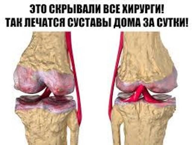 eto-skryvali-vse-hirurgi-tak-lechatsya-sustavy-doma-za-sutki-eta-mikstura-skoraya-pomosch-ot-boli-v-sustavah-1-6255362